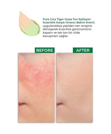 Sinoz Pure Cica Tiger Grass Tone Equalizing Intensive Repairing Soothing Anti-Redness Face Cream 15 ml - Buy Online on GoSupps.com