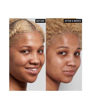 THE INKEY LIST Tranexamic Acid Hyperpigmentation Night Treatment - Skin Equalizing Night Care - Buy Online on GoSupps.com