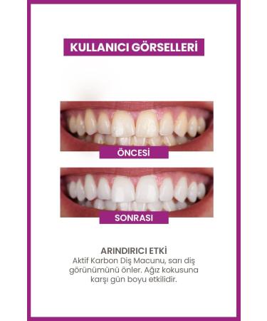 Luis Bien Active Carbon Teeth Whitening Paste | Permanent Effect | 75 ml - Buy Online on GoSupps.com