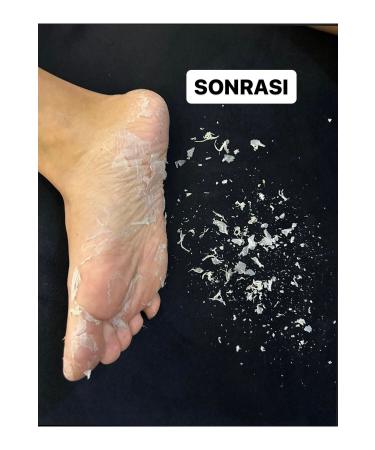 HODAF 1 Pair Sock Type Peelable Lemon Flavored Foot Peeling Mask for Dead Skin and Cracks - Buy Online on GoSupps.com