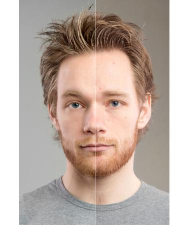 Rosawomans BLACK HEAD OFF AHA BHA GEL Blackheads Acne Pimples and Dead Skin 60ML - Buy Online on GoSupps.com