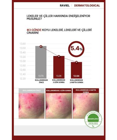 RAVIEL JUST ENOUGH Panthenol Dark Spot Blemish Cream For Dark Spots - Buy Online on GoSupps.com