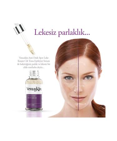 VenuSkin Anti-Spot Arbutin Skin Care Serum 30 Ml (arbutin + Hyaluronic Acid) - Buy Online on GoSupps.com