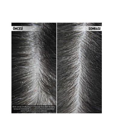 Oriflame DUOLOGI Anti-Dandruff Effective Purifying and Scalp Renewing Shampoo - Buy Online on GoSupps.com