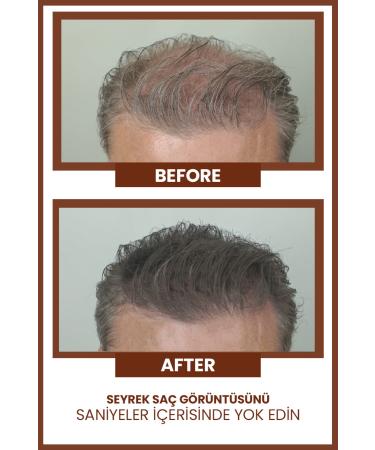 Luis Bien Hair Volumizing Powder Fiber- Brown 8681967480771 - Buy Online on GoSupps.com