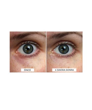 VITAYES Eye Contour Peptide Complex Serum Revitalizing & Firming Care for Dark Circles and Bags - Buy Online on GoSupps.com