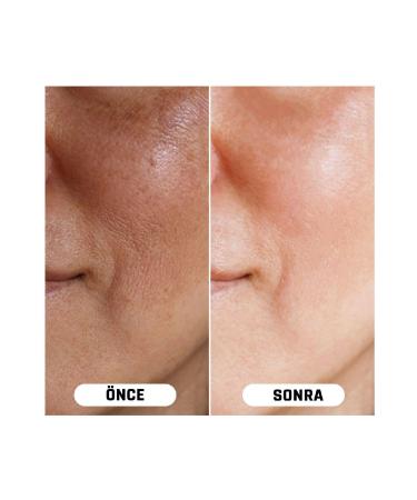 VITAYES Vitamin C Skin Tone Equalizer Anti-Spot Hyaluronic Acid Brightening Moisturizing Skin Serum - Buy Online on GoSupps.com