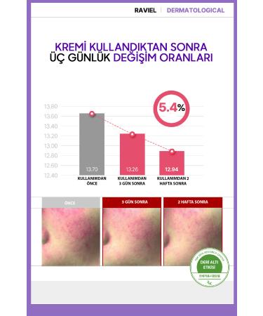 RAVIEL JUST ENOUGH Dark Spots Serum and Bakuchiol Cream with Vita C - Buy Online on GoSupps.com