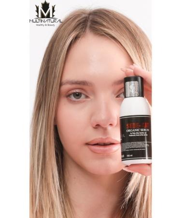 multinatural 100ml Sede-kat Itch Cream Hives Hand Foot Fungus Scabies Eczema Anti Eczema-nm Cream - Buy Online on GoSupps.com