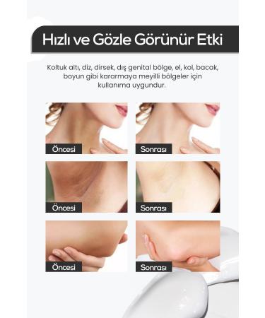 natural whitening skin whitening cream Skin Whitening Anti-Stain Care Cream 100ml - Buy Online on GoSupps.com