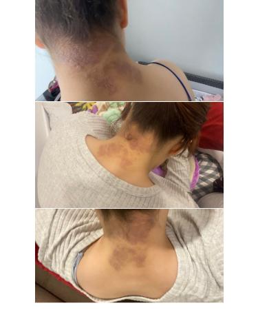 Wien 0 Natural Eczema Cream 150 ml