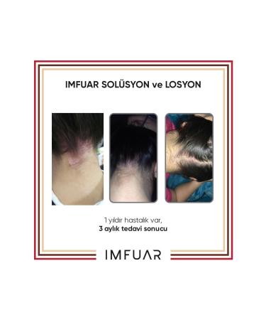 IMFUAR HAIR AND SKIN SOLUTION 50ML + LOTION 25ML - Buy Online on GoSupps.com