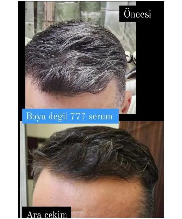 gonul celebrity 777 Hair Care Serum Formulated with 0 Pure Herbal Oils 50 ml - Buy Online on GoSupps.com