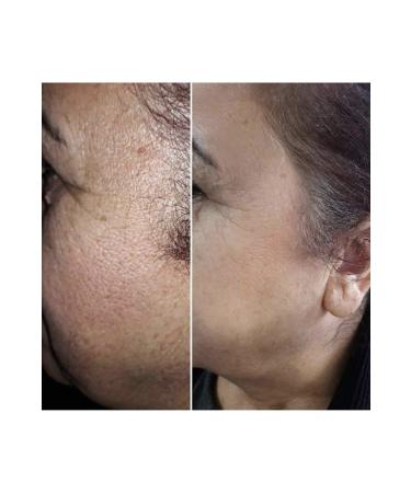 EG COSMET CS Dermadelete Peeling Cream - Buy Online on GoSupps.com