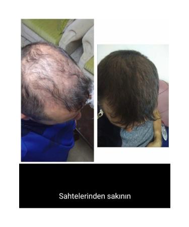 Blue Serum Hair Serum Blue Lotion Hairon Plus - Buy Online on GoSupps.com