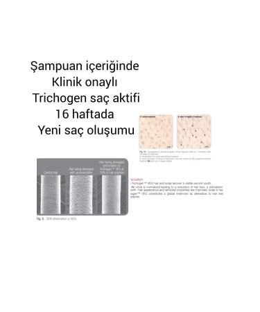 NSL Collagen and Keratin Anti-Hair Loss Fast Hair Growth Nourishing Sulfate-Free Salt-Free Shampoo - Buy Online on GoSupps.com