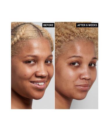 THE INKEY LIST NIACINAMIDE - Serum 30 ml - Buy Online on GoSupps.com