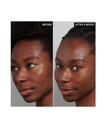 THE INKEY LIST Tranexamic Acid Hyperpigmentation Night Treatment - Skin Equalizing Night Care 30 ML - Buy Online on GoSupps.com