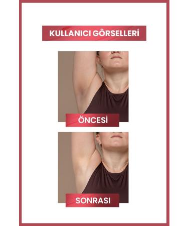 Luis Bien Skin Whitening Cream | Anti-Stain | Brightening Care | 50ml | Skin Whitening - Buy Online on GoSupps.com