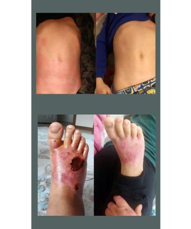 Anatolian Creamozone Moisturizing Cream Sunscreen Effective Health Skin Ozone Aloe Vera 15 Spf - Buy Online on GoSupps.com