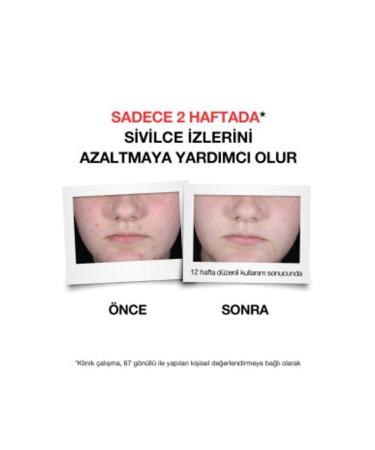 Neutrogena Anti-Acne Plus Cleansing Gel 200 ml - Buy Online on GoSupps.com