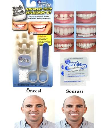 qualityworld Teeth Repair Kit Missing Teeth Repair Kit Perfect Oral Care Smile Smile With Confidence