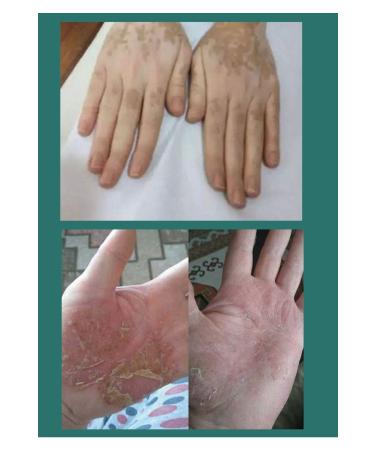 Cosmozone Anti-aging Cream Anti-aging Anti-Spot Repair Cream Ozone 200x Aloe Vera - Buy Online on GoSupps.com