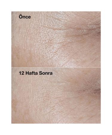 Clinique SMART CLINICAL REPAIR - SPF 30 FACE CREAM 75ML KEYON3235 - Buy Online on GoSupps.com