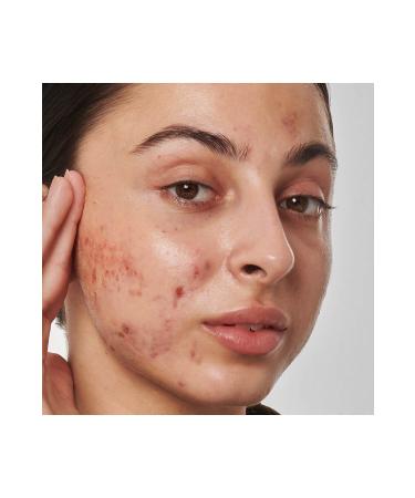 THE INKEY LIST Scar mark and wrinkle solution with 1% retinol - Face Serum 30 ml - Buy Online on GoSupps.com
