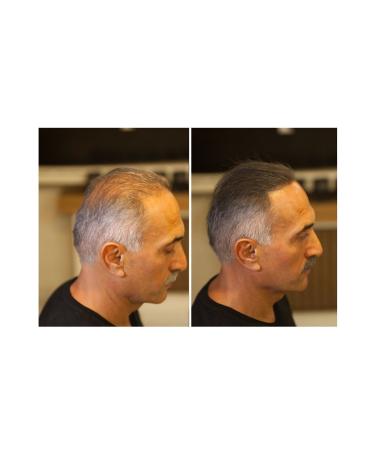 FIXPLANT Hair Volumizer 2 Bottles Topik 56 Gr. | Hair Powder for Thin Hair | Hair Fiber - Buy Online on GoSupps.com