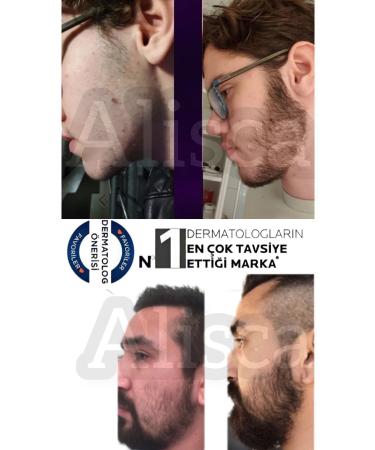 Alisca Beard Serum - mustache - helps beard formation - helps eyebrow formation - Beard Thickener - Buy Online on GoSupps.com