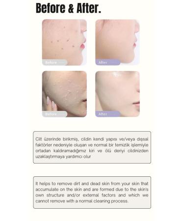 HOZMETIC Instant Peeling Cream Exfoliating Dead Skin Purifying Renewing Pore Brightening Body Face Peeling Gel - Buy Online on GoSupps.com