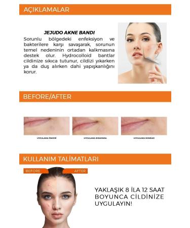 JEJUDO Ceuticals Original Pimple Patch 36 Patch - Acne and Pimple Patch - Buy Online on GoSupps.com