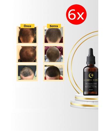 La Miera Norel 6 Men's Hair Growth Serum - Nourishes Strengthens Accelerates Hair Growth