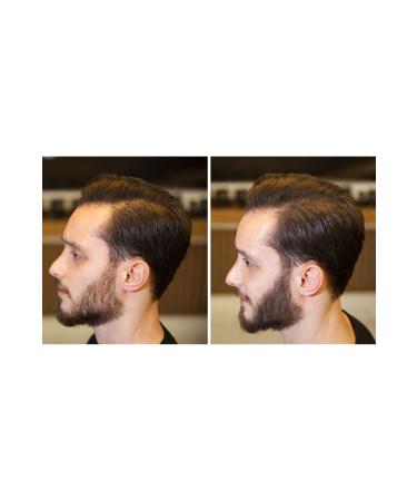 Fixbeard Beard & Moustache Thickening Powder 14 Gr | Powder for Sparse Beard Moustache | Fixbeard Water-Resistant - Buy Online on GoSupps.com