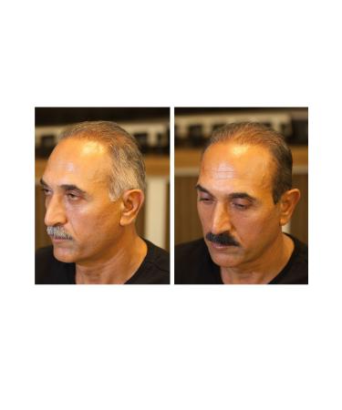 FIXPLANT Fixwhite White Concealer Touch Up Pen 20 ml | Hair Beard Moustache White Concealer - Buy Online on GoSupps.com