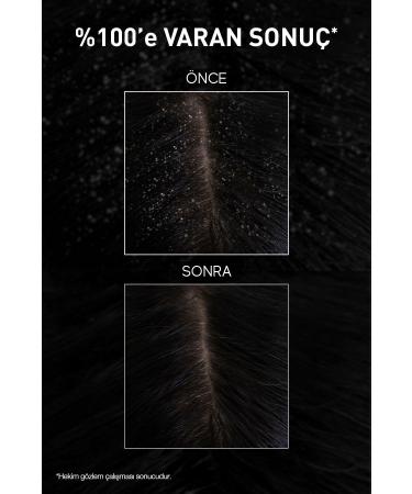 Bioxcin Aqua Thermal DS Intensive Anti-Dandruff Shampoo 200 ml Set of 2 - Buy Online on GoSupps.com