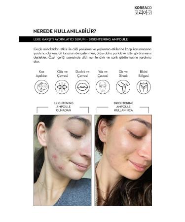 KOREACO Anti-Spot & Skin Tone Brightening Ampoule - Buy Online on GoSupps.com