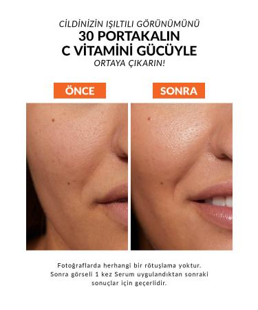 Avon Anew Radiance Maximising Vitamin C Face Serum 10 Ml. - Buy Online on GoSupps.com