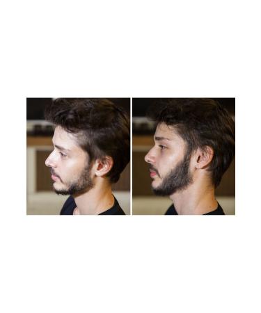 Fixbeard Beard & Moustache Thickening Powder 14 Gr | Powder for Sparse Beard Moustache | Fixbeard Water-Resistant - Buy Online on GoSupps.com