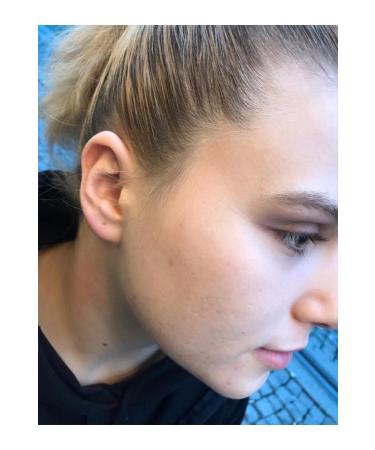 Oxo Global Anti Aging Longevity Skin Tightening Youthful Appearance Anti Aging Serum - Buy Online on GoSupps.com