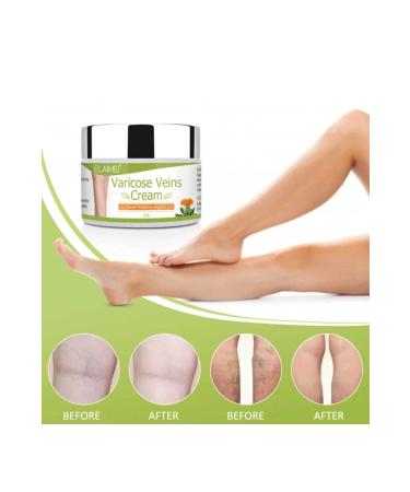 ELAIMEI Elamei Spider Varicose Veins Cream Varicose Cellulite Knee Leg Care Cream 2 Pieces - 100 Ml - Buy Online on GoSupps.com