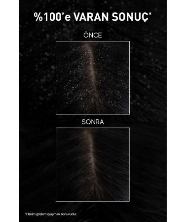 Bioxcin Aqua Thermal DS Intensive Anti-Dandruff Shampoo 200 ml 3-pack - Buy Online on GoSupps.com