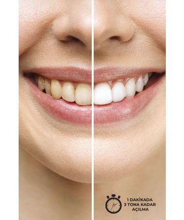 arydent Teeth Cleaning Gel 10 ml - Buy Online on GoSupps.com