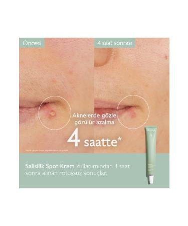 Caudalie Vinopure Anti-Acne Salicylic Spot Cream 15 ml - Buy Online on GoSupps.com