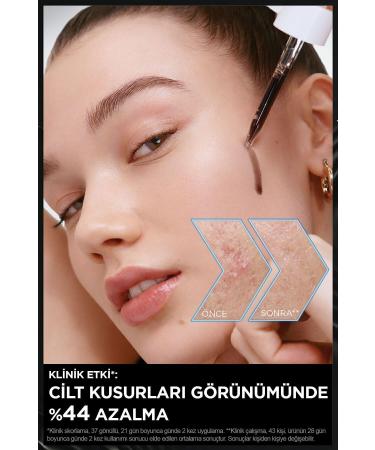 Garnier Aha Bha Anti-Imperfection Serum 4% niacinamide Peeling Aha Bha 30ml - Buy Online on GoSupps.com