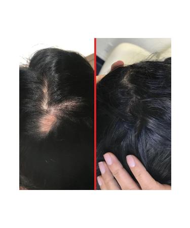 HAIRtamin Hrtn2845 Hair Vitamin - Buy Online on GoSupps.com