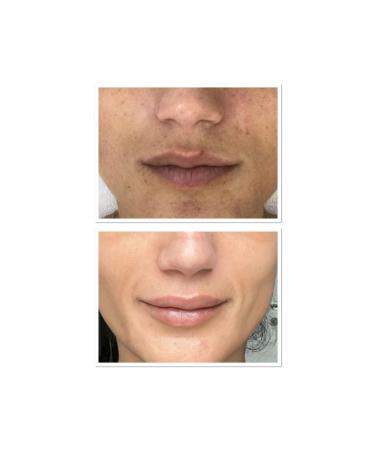 Oxo Global Provides Stem Cell Treatment Facial Cleansing Skin Cleansing Youth Restoring Cleanser 200 ml - Buy Online on GoSupps.com