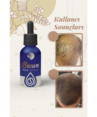 Brown Hair Growth and Care Serum - Buy Online on GoSupps.com