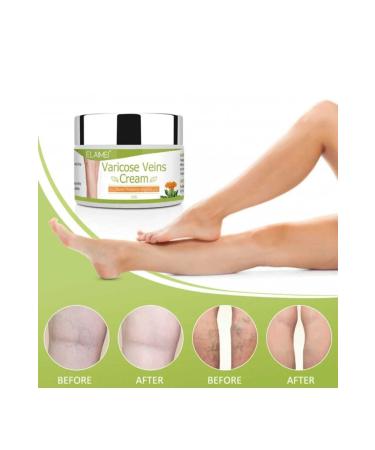 ELAIMEI Spider Varicose Veins Cream Varicose cellulite knee leg care cream 3 pieces - 100 ml - Buy Online on GoSupps.com